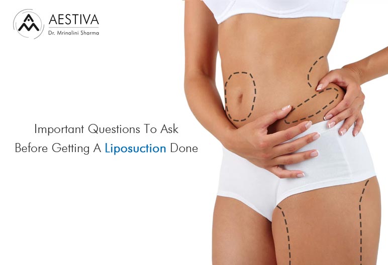 Important Questions To Ask Before Getting A Liposuction Done