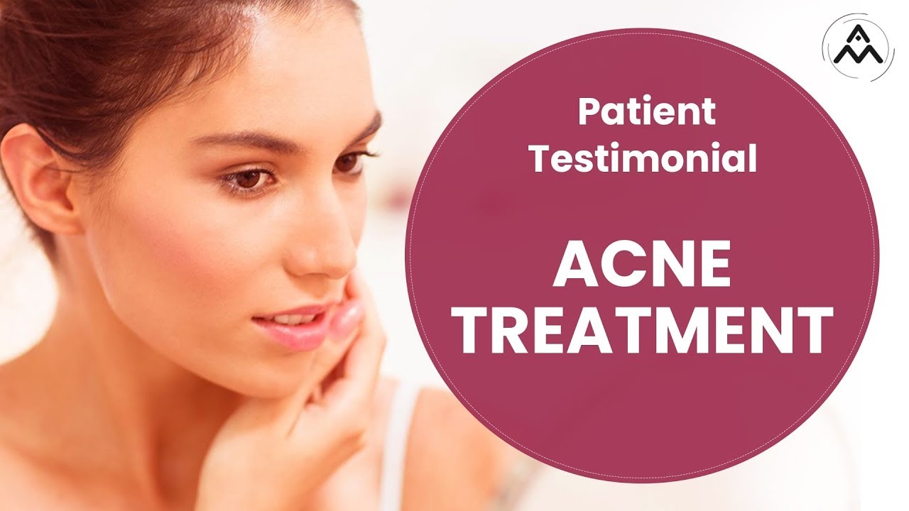Patient Testimonial - Acne Treatment | Aestiva Plastic Surgery Clinic in New Delhi